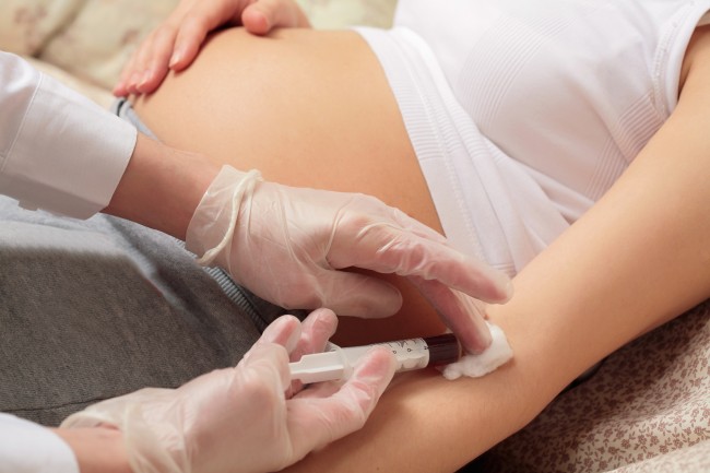 Materni T21 test in pregnancy