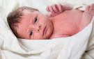 newborn skin conditions