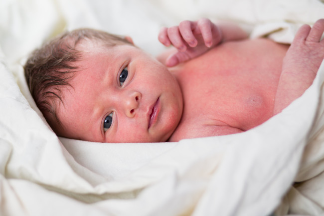 newborn skin conditions