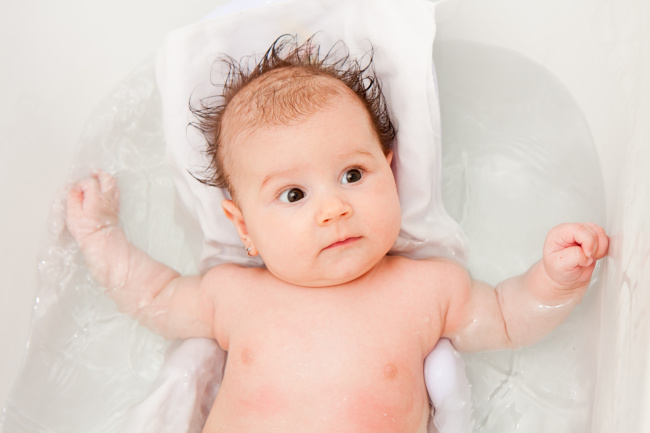 cradle cap